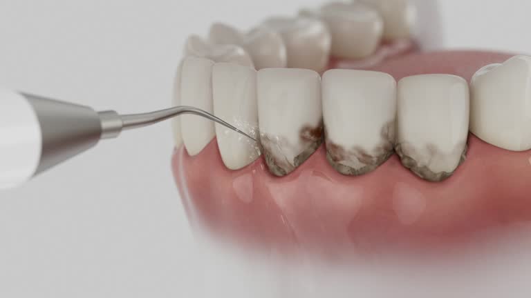 Trusted Teeth Cleaning And Checkup service in Cockeysville, MD - Dentist Open Now